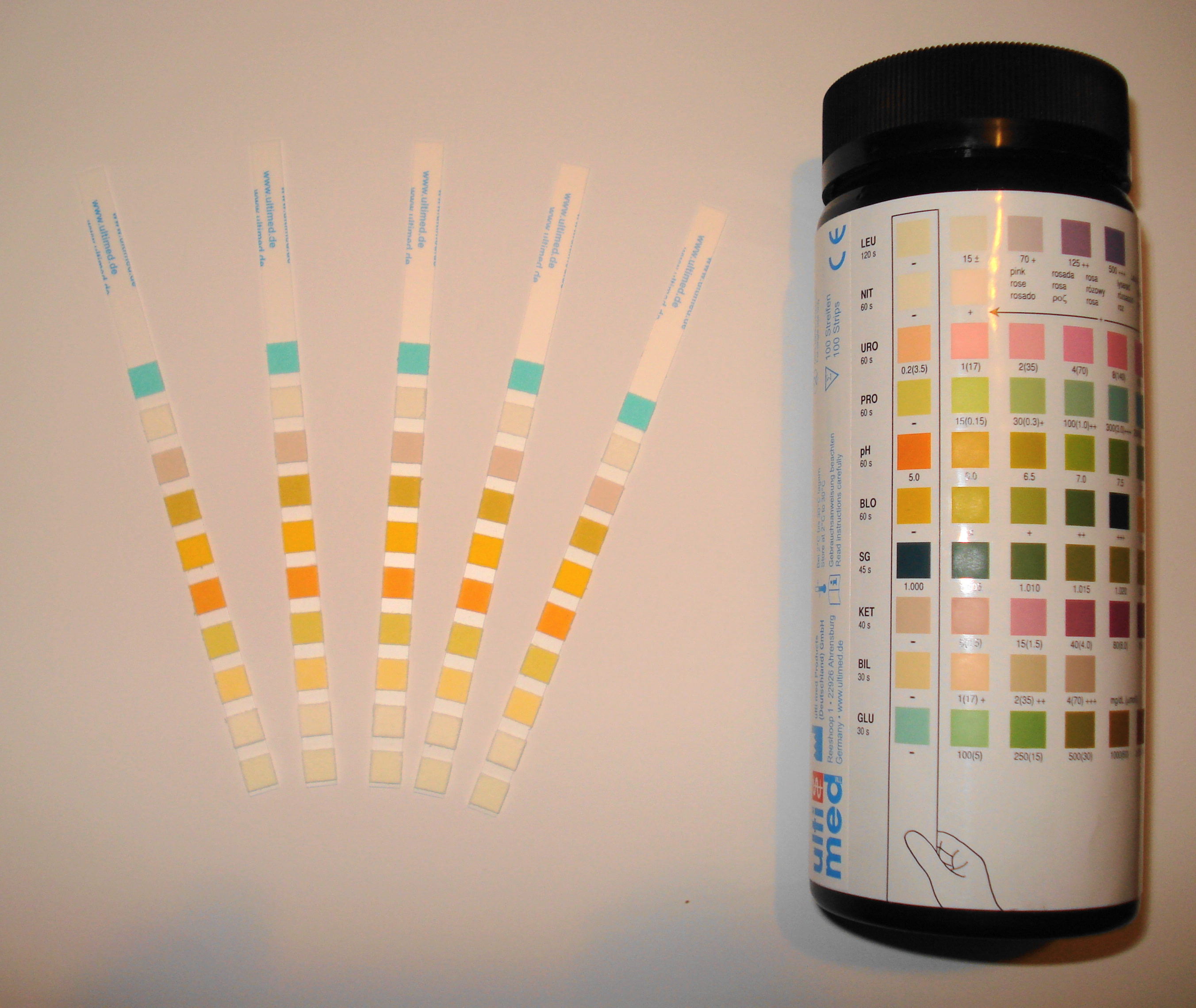 Siemens Urine Test Chart